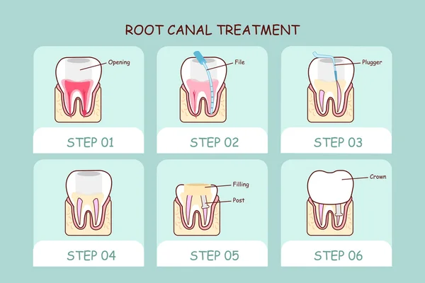 Endodontics, High River